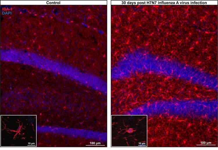 آنفلوآنزا ممکن است به مغز آسیب برساند!